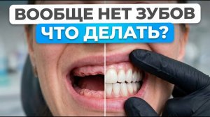 ДЕЛАЙТЕ ЭТО, если у вас НЕТ ЗУБОВ! Можно ли ставить импланты на все зубы?