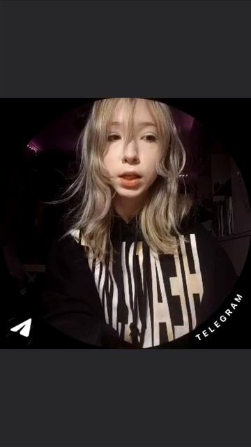 История как я подвернула ногу в прошлом видио