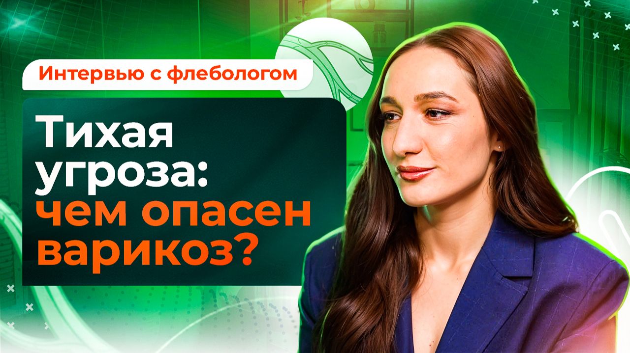 Варикоз: все о диагностике и лечении