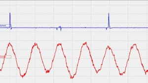 Датчик разрежения .Проверка грм осциллографом.