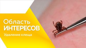 Область интересов : Роспотреб удаление клеща