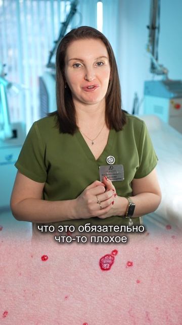 Заметили у себя такие красные точки 