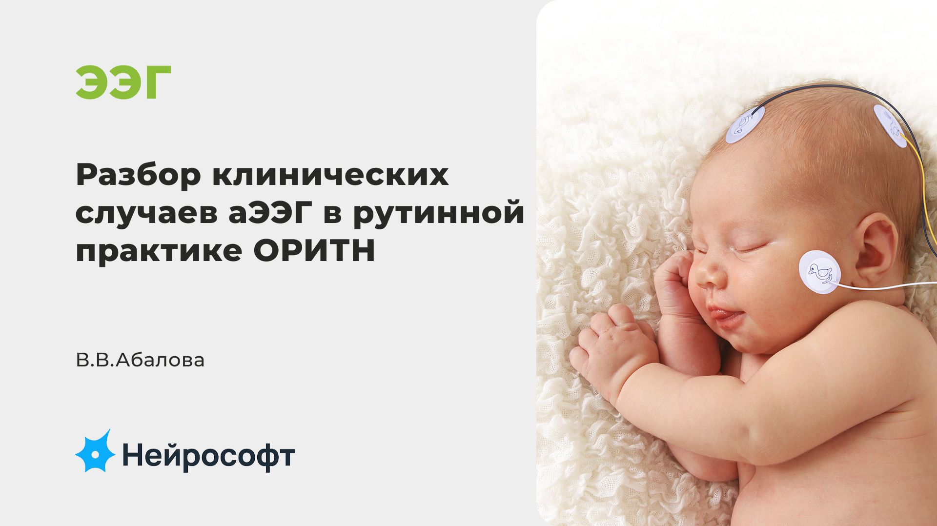 Разбор клинических случаев аЭЭГ в рутинной практике ОРИТН | В.В.Абалова