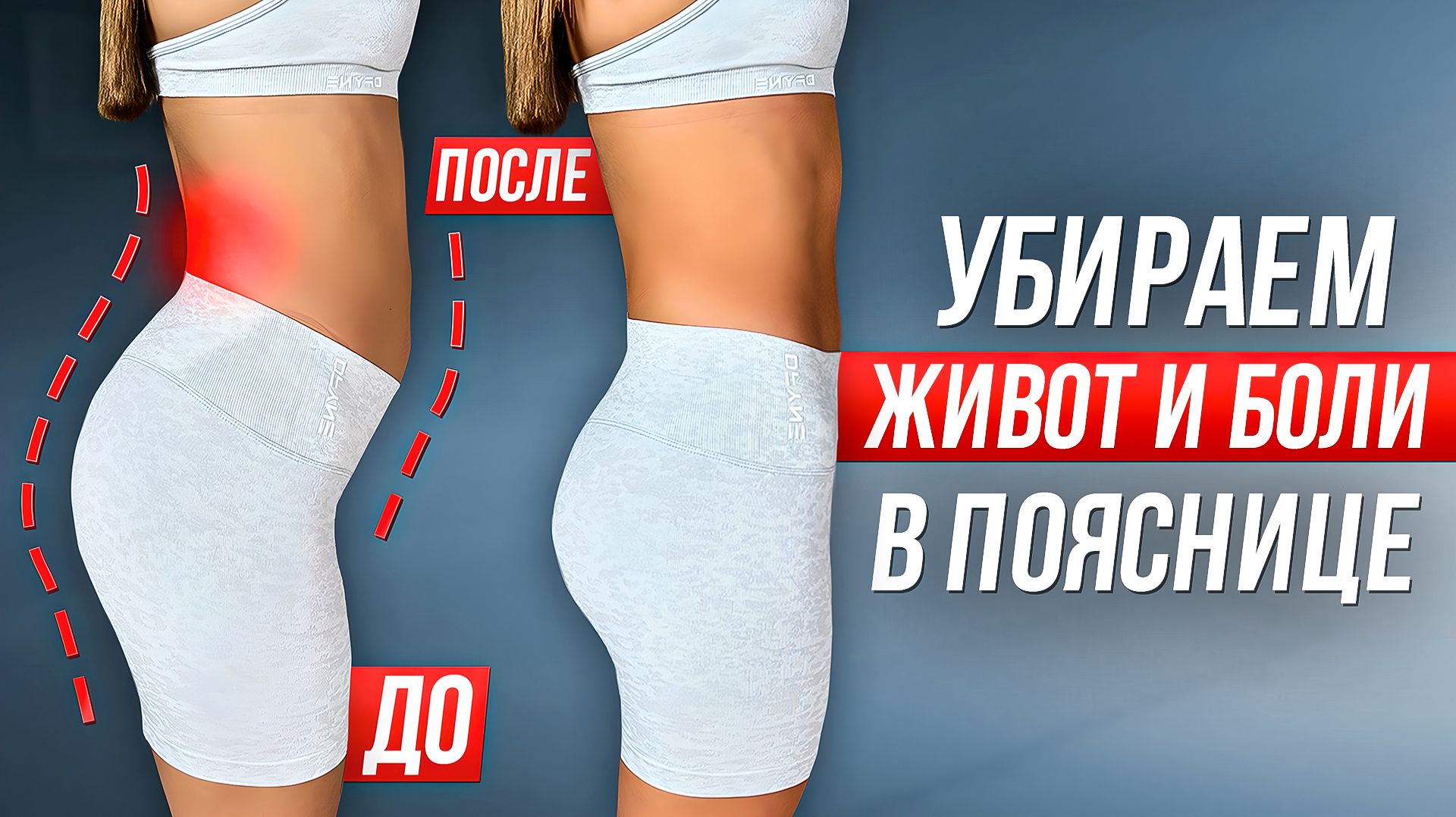 ТЕСТ НА ГИПЕРЛОРДОЗ И ТОП-5 УПРАЖНЕНИЙ ДЛЯ РЕШЕНИЯ ЭТОЙ ПРОБЛЕМЫ!