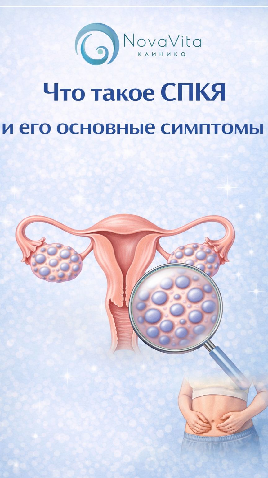 Синдром поликистозных яичников