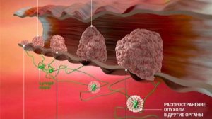 САМЫЙ ПОЗНАВАТЕЛЬНЫЙ КАНАЛ. ВСЁ О РАКЕ ПРОСТАТЫ.