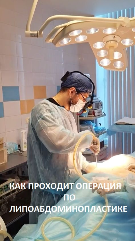Операция по липоабдоминопластике