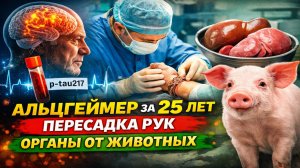 Новости науки 71 : Альцгеймер можно обнаружить за 25 лет