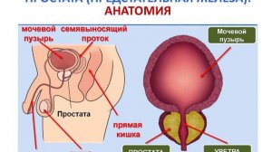 САМЫЙ ПОЗНАВАТЕЛЬНЫЙ КАНАЛ. ВСЁ О РАКЕ ПРОСТАТЫ.