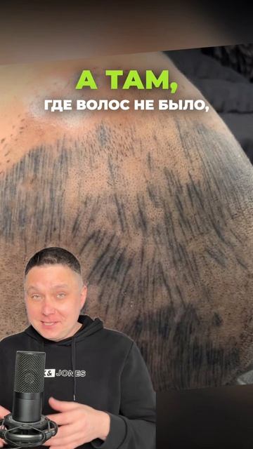 Блог про удаление ПМ и тату!  Подписывайся! #лазерноеудалениятату #перманентныймакияж #татуаж