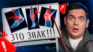 Очень сильно болят ноги? ЭТО ОГРОМНЫЙ ЗНАК ТВОЕГО ТЕЛА!