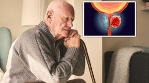 САМЫЙ ПОЗНАВАТЕЛЬНЫЙ КАНАЛ. ВСЁ О РАКЕ ПРОСТАТЫ.