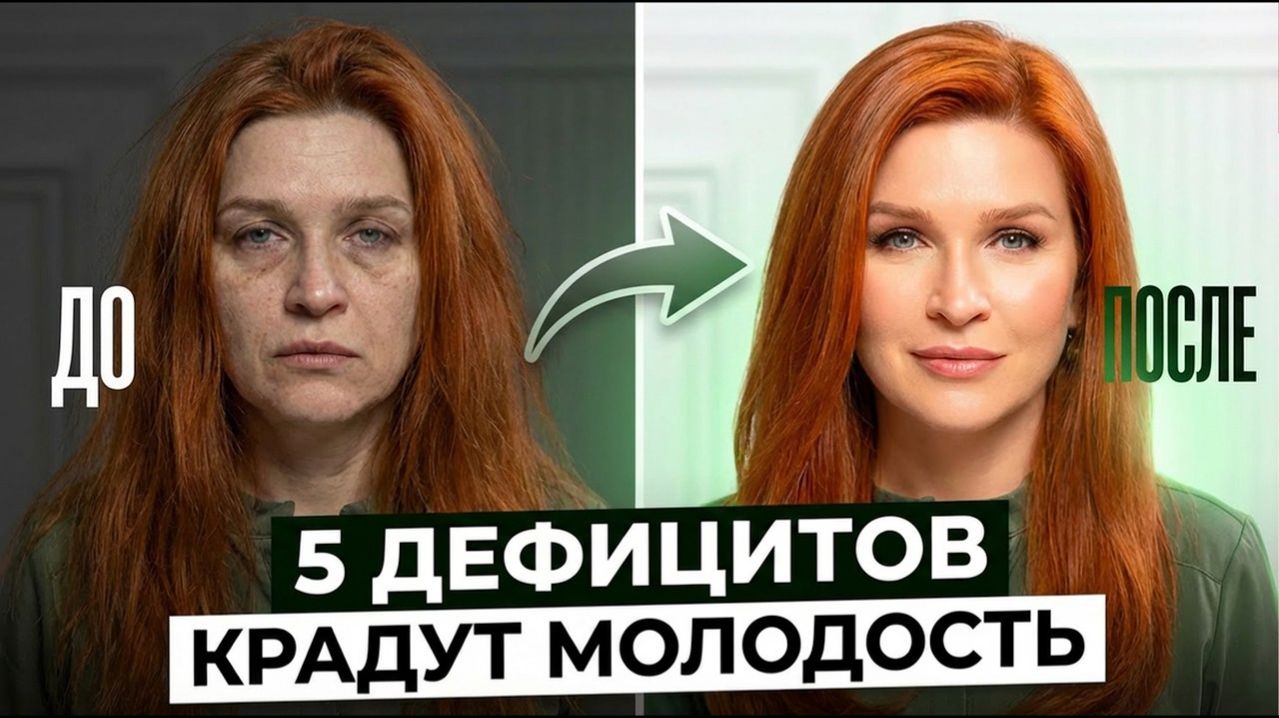 5 дефицитов, которые КРАДУТ женскую молодость и красоту!