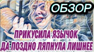 САМВЕЛ АДАМЯН,ВОНХ РЕШИЛА ПОЩЕКОТАТЬ СЕБЕ НЕРВЫ,ПРОВЕЛА РАССЛЕДОВАНИЕ КУРИНЫМИ МОЗГАМИ