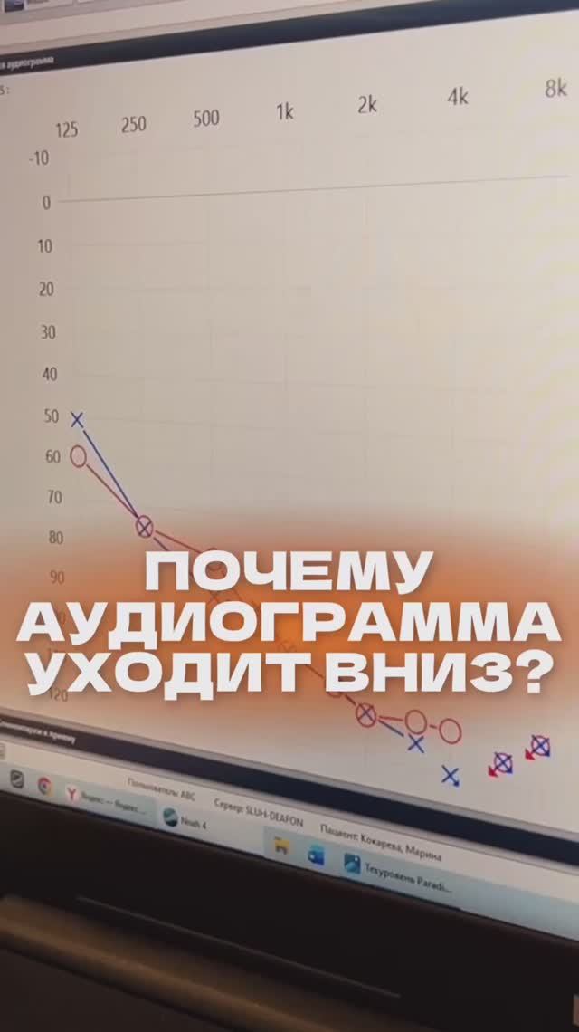 Почему аудиограмма уходит вниз?