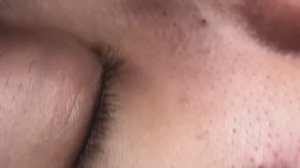 Отличная чистка лица от акне. Результат превосходный.