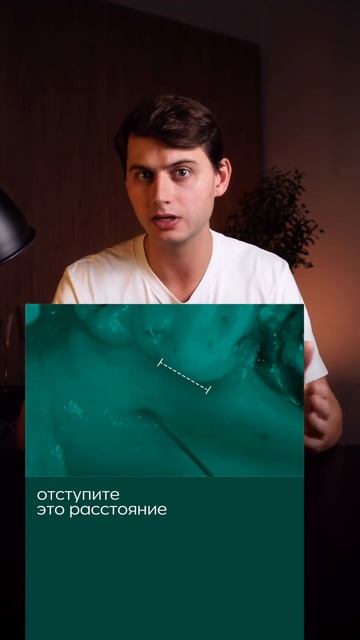 Безболезненное удаление зуба мудрости