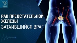 САМЫЙ ПОЗНАВАТЕЛЬНЫЙ КАНАЛ. ВСЁ О РАКЕ ПРОСТАТЫ.