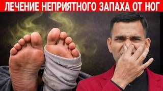 КАК УБРАТЬ НЕПРИЯТНЫЙ ЗАПАХ НОГ?