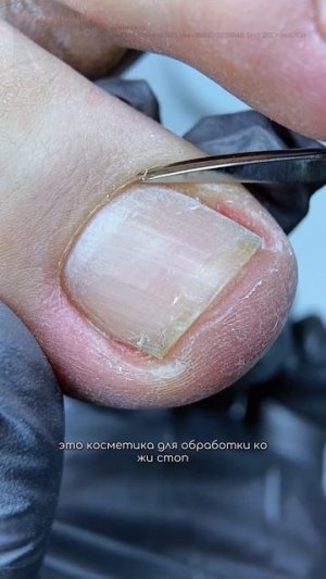 А к вам часто приходят клиенты на педикюр с таким исходником? 🤔