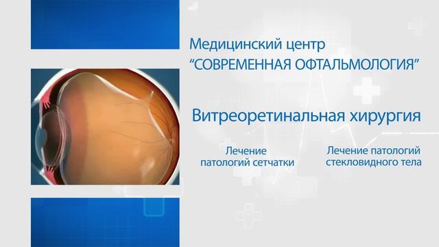 Современная Офтальмология фильм 6 минут-quicktime