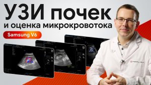 УЗИ почек на Samsung V6: измерения и оценка микрокровотока в реальной практике