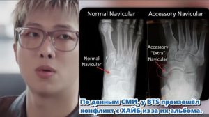 Big Hit Music опубликовали обновление. Во время репетиции 19 марта RM повредил лодыжку...