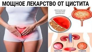 МОЩНОЕ ЛЕКАРСТВО ОТ ЦИСТИТА. ЭТО РЕАЛЬНО ПОМОЖЕТ ВАМ.