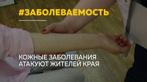 Палаты переполнены в Алтайском крае растет заболеваемость кожными болезнями