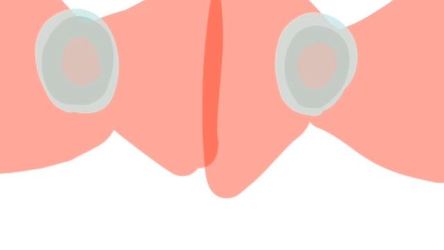 Заражения, часть 2.