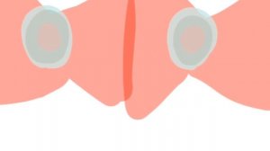 Заражения, часть 2.