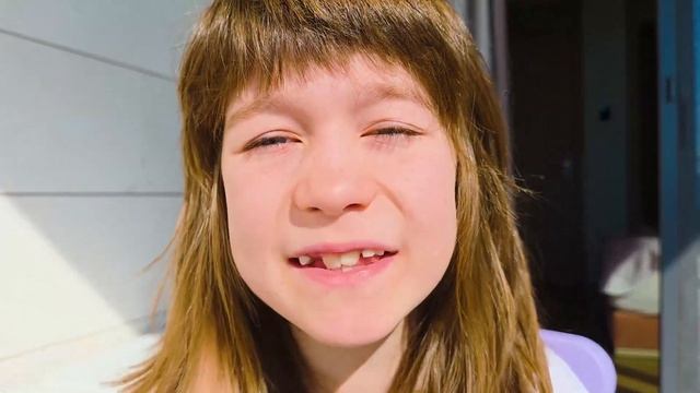 Бьянка чистит зубы капибаре. Здоровые зубы нужны всем! 