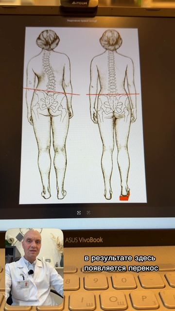 Почему у человека правая нога короче?