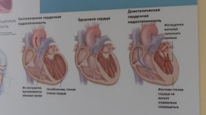 Год на страже здоровья: итоги работы кардиологического отделения рязанской ОКБ