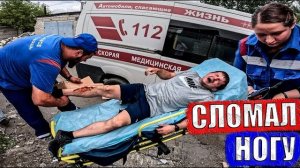 ДИМА СЛОМАЛ НОГУ