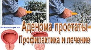 САМЫЙ ПОЗНАВАТЕЛЬНЫЙ КАНАЛ. ВСЁ О РАКЕ ПРОСТАТЫ.