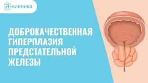 САМЫЙ ПОЗНАВАТЕЛЬНЫЙ КАНАЛ. ВСЁ О РАКЕ ПРОСТАТЫ.