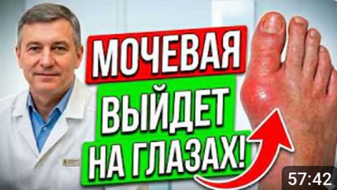 Кто бы мог подумать, что подагра боится обычной. Один продукт — и приступы уходя