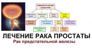 САМЫЙ ПОЗНАВАТЕЛЬНЫЙ КАНАЛ. ВСЁ О РАКЕ ПРОСТАТЫ.