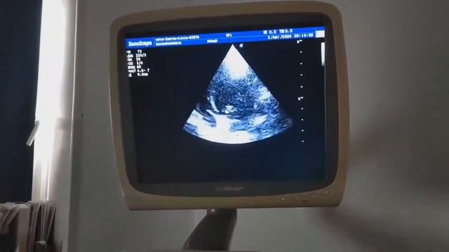 Когда за улыбкой прячется боль… Спаниелю срочно нужна операция! | Хильда