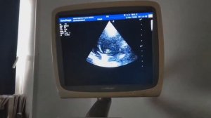 Когда за улыбкой прячется боль… Спаниелю срочно нужна операция! | Хильда