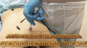 Гирудотерапия в клинике «Гиппократ» (ст. Ленинградская): лечение пиявками по природным технологиям