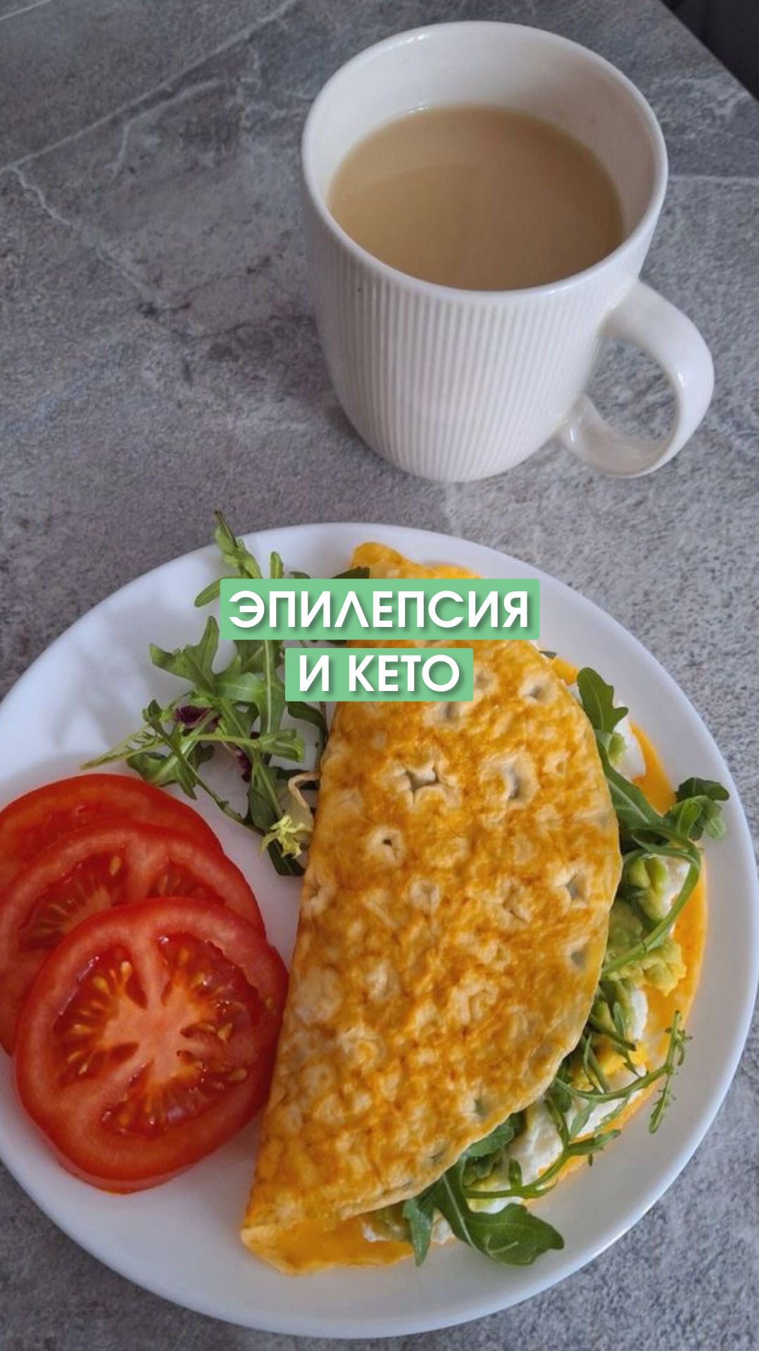 Надо ли пациентов с эпилепсией переводить на кето?