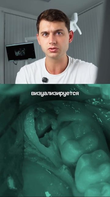 Протокол удаления зачатка зуба мудрости