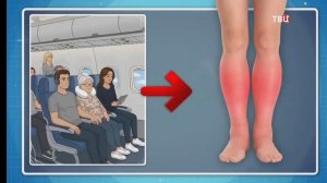 Как выявить проблемы с венами на ранних стадиях болезни. Флеболог Москва.