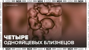 Однояйцевые четверняшки появились на свет в Санкт-Петербурге - Москва 24