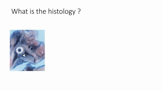 Thromboembolism ISICEM 45