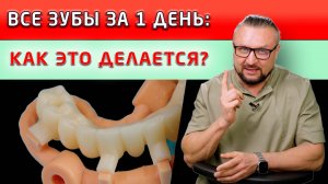 Как устанавливаются все зубы за один день: технически и поэтапно.