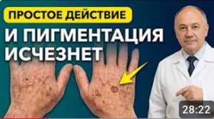 Коричневые пятна на руках Ваш организм кричит о нехватке ОДНОГО минерала