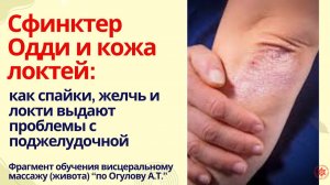 Сфинктер Одди и кожа локтей: как спайки, желчь и локти выдают проблемы с поджелудочной.